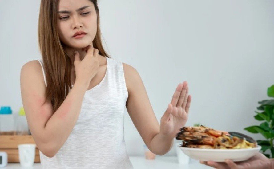 Beyond the Plate - How Food Allergies Impact Daily Life